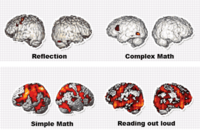 Lesen aktiviert das Gehirn - Schema